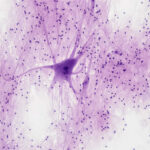 When Neurons Get Tied Up in Knots: Human Fallibility and Folly in Asylum Psychiatry