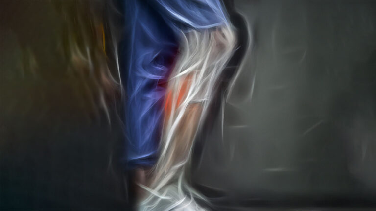 Imagining Phantom Limb Pain