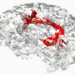 Feeling Dementia from the Play, The Father