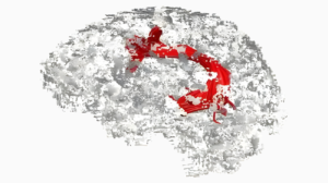 Feeling Dementia from the Play, The Father