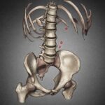 How Montaigne Profited from His Kidney Stones