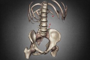 How Montaigne Profited from His Kidney Stones